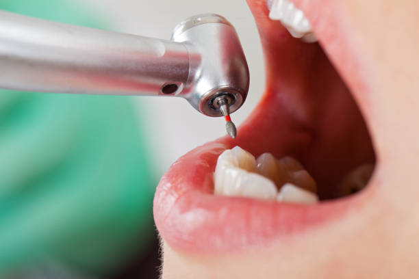 Best Emergency Dental Care for Broken or Chipped Teeth in Bradford, TN